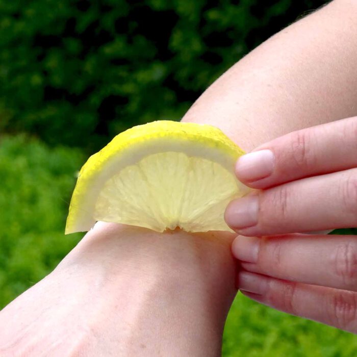 Zitronenscheiben kühlen und desinfizieren bei Insektenstichen.
